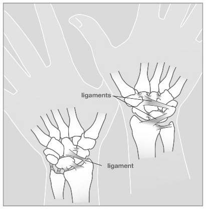 Wristsprains_image1